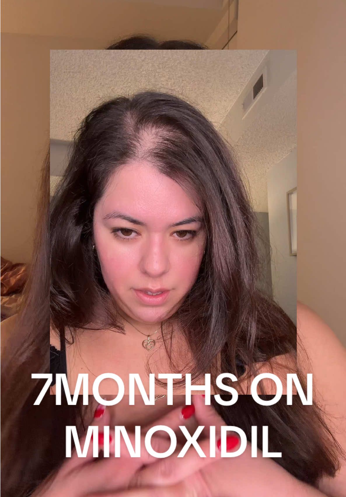 @Bianca