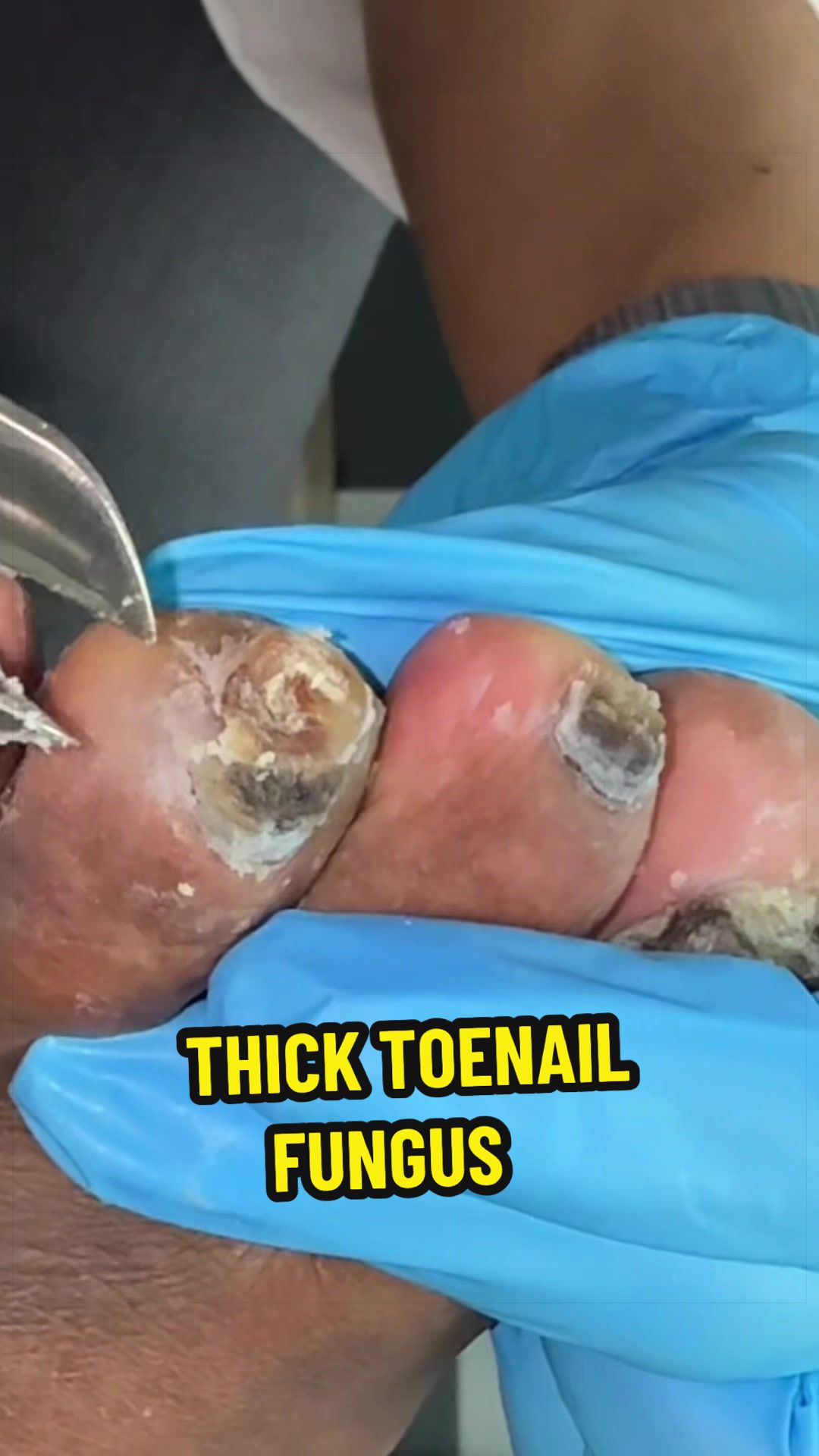 @Deniel Foot and Ankle Center