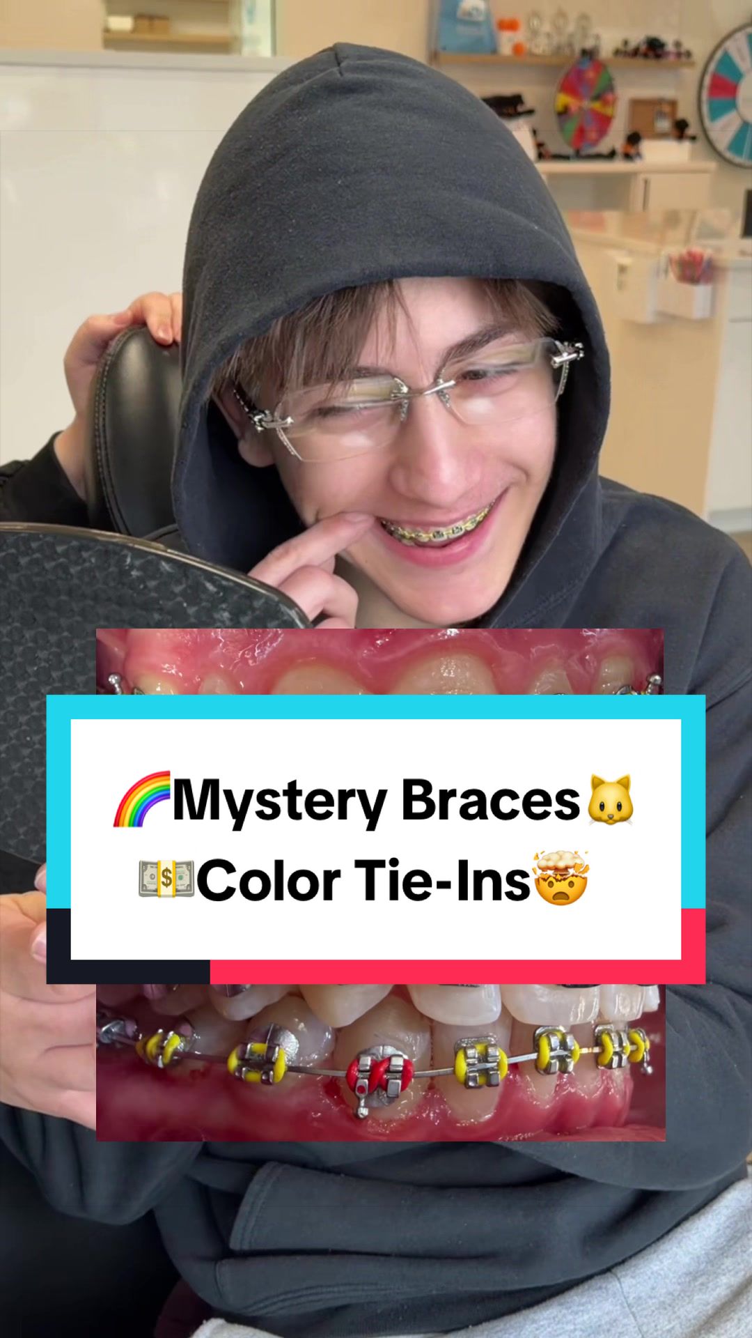 @Braces Survival Guide