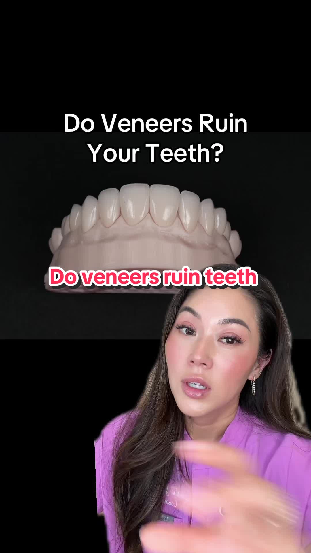@Joycethedentist OC Veneers