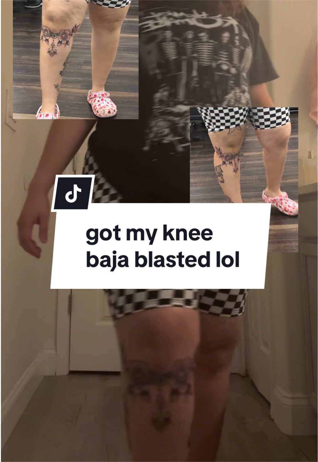 @em