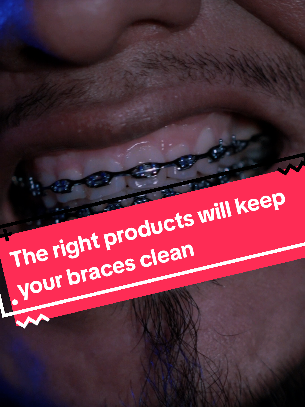 @str8braces