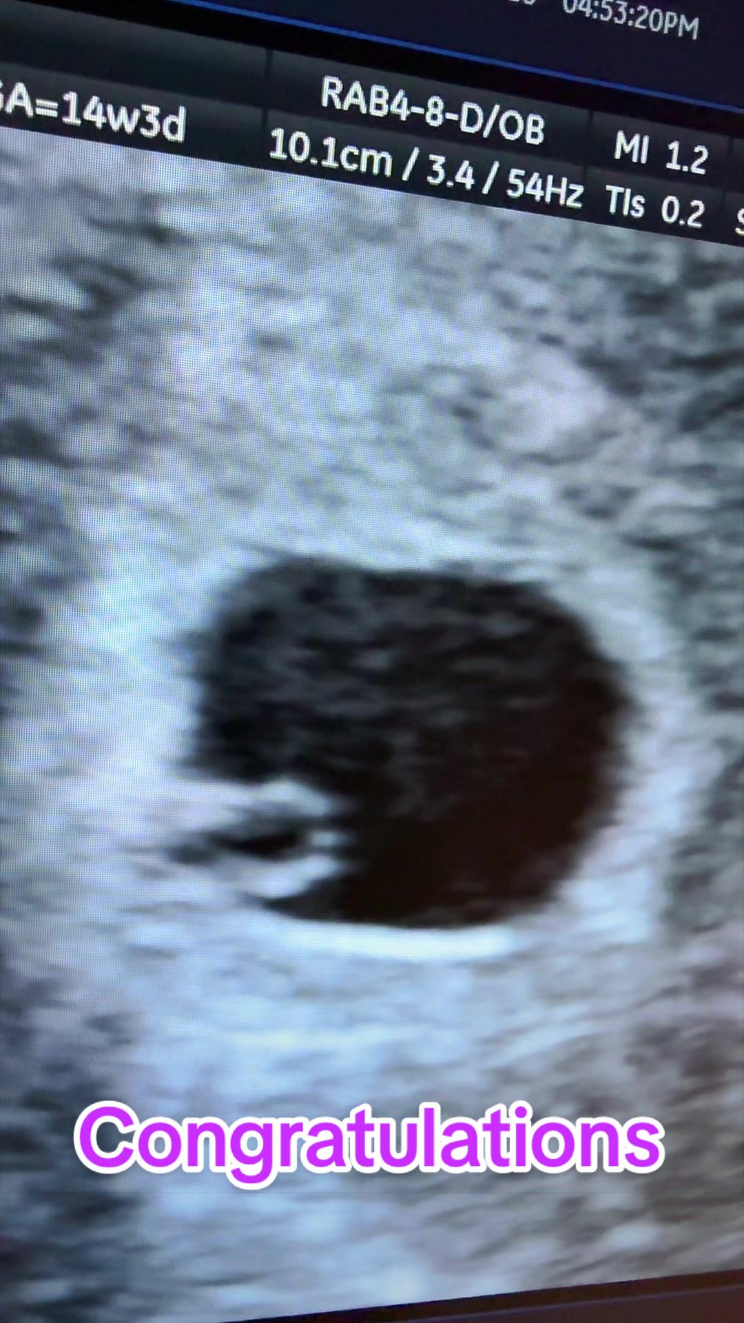 @PregnantSee Inc.