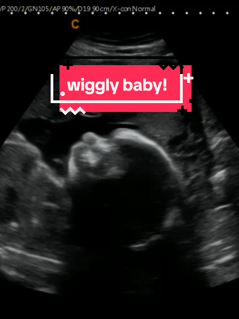 @Hey, Baby!