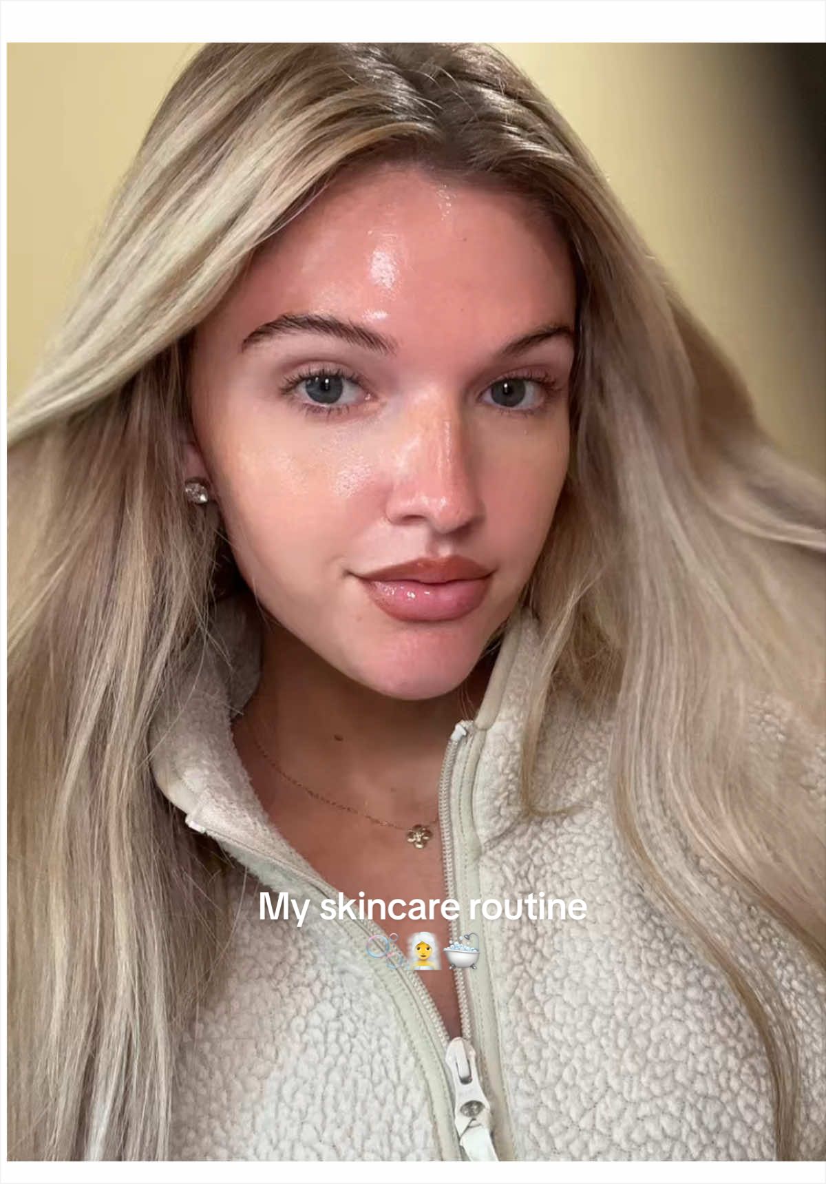@allydirnberger