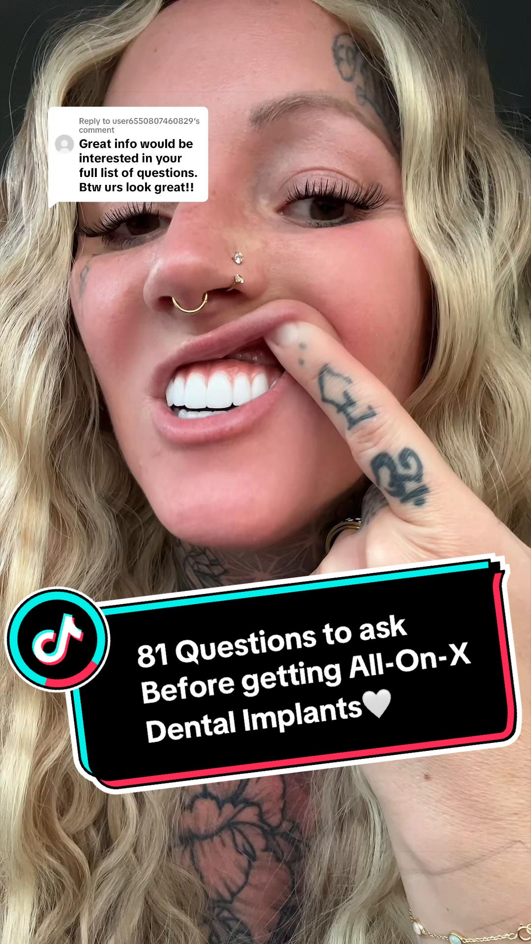 @denturegirly OG