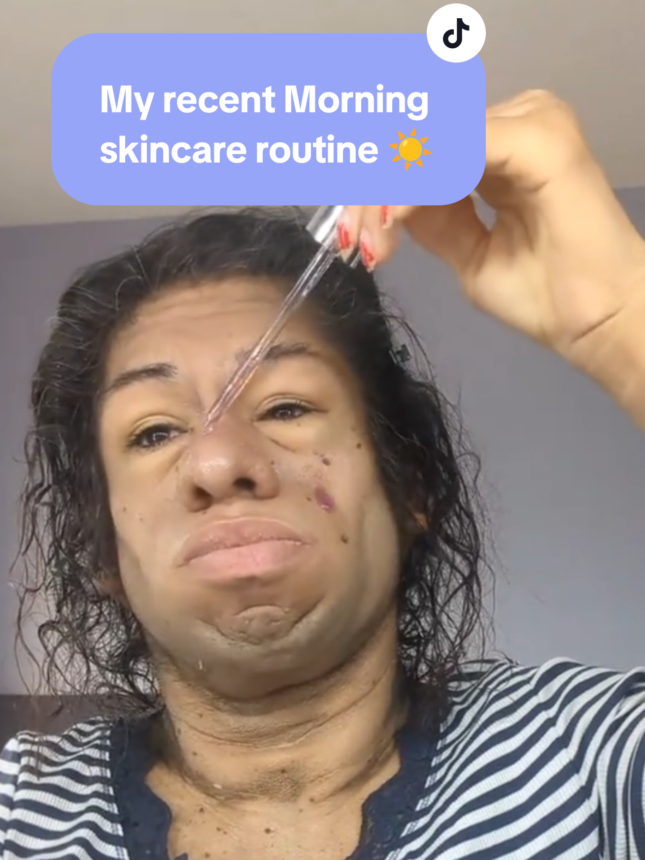@Yessimperfections