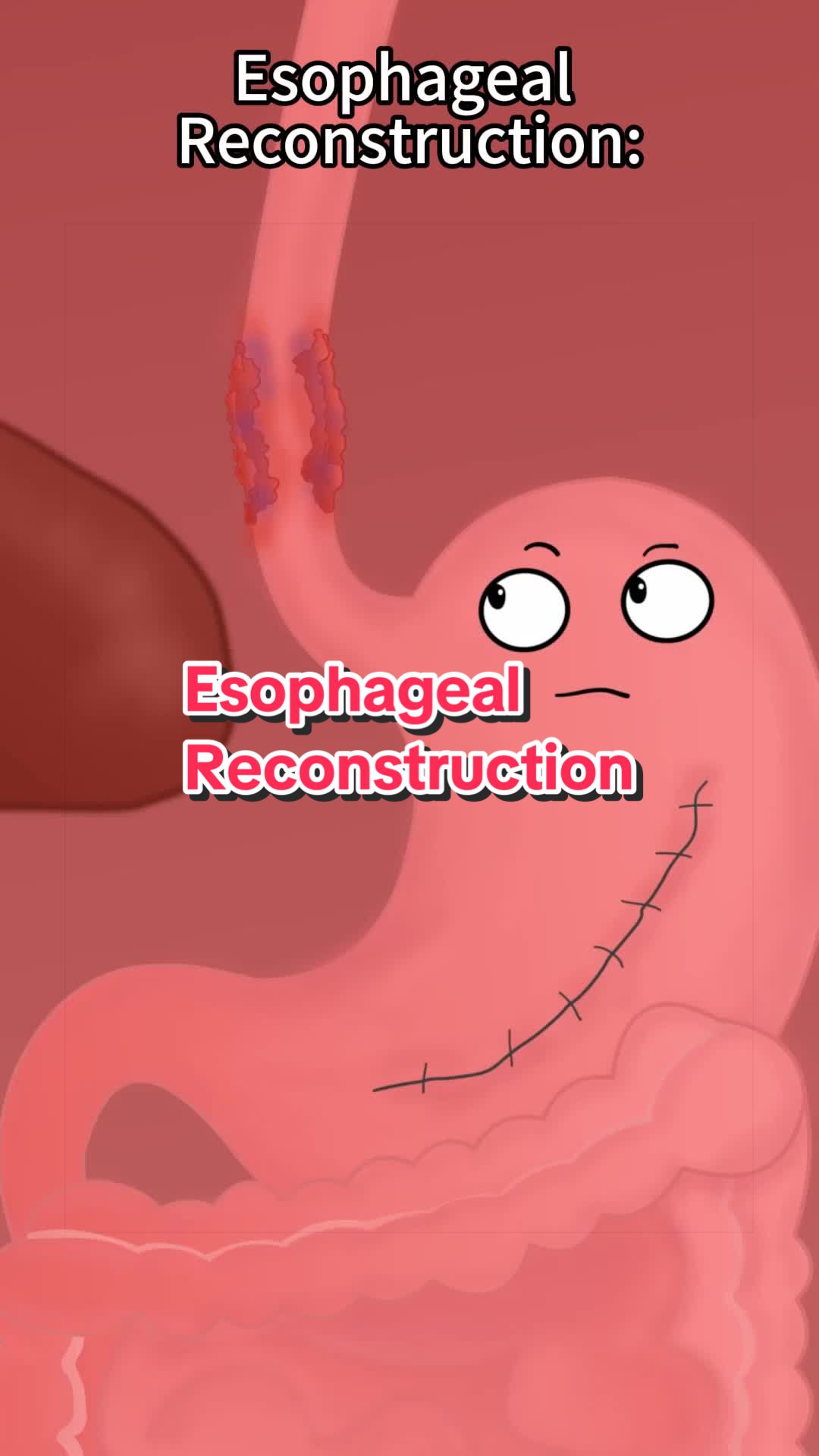 @Funny Animations