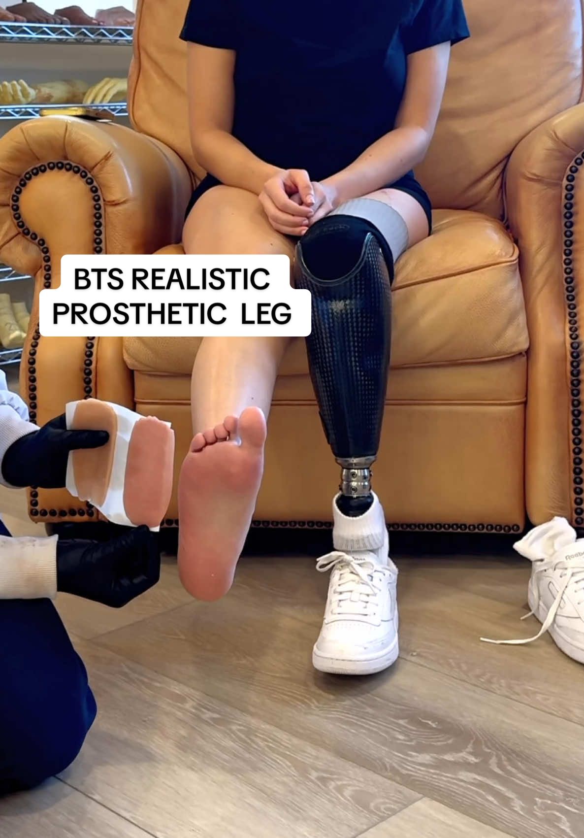 @A Step Ahead Prosthetics