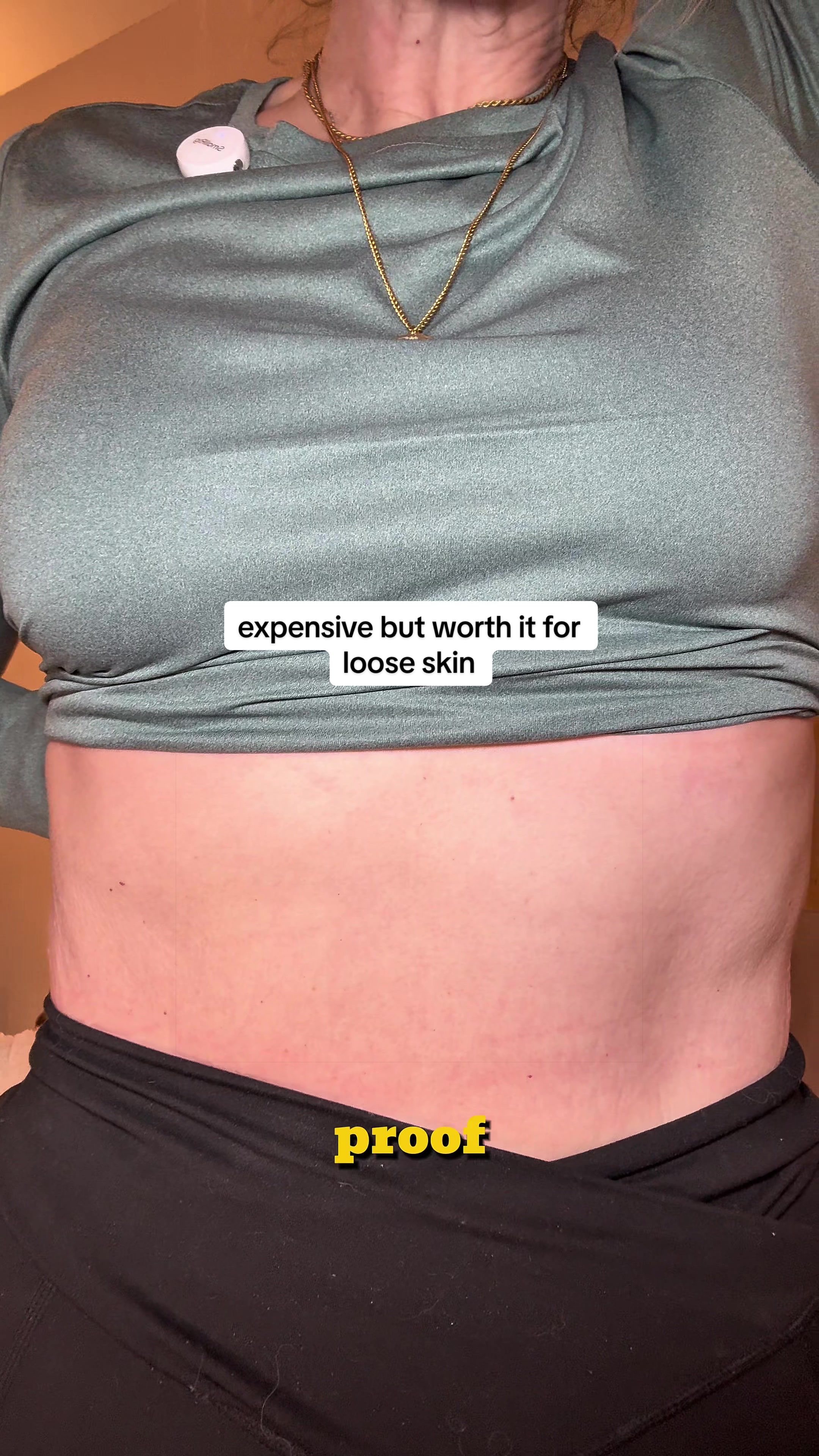 @Katherine Cares