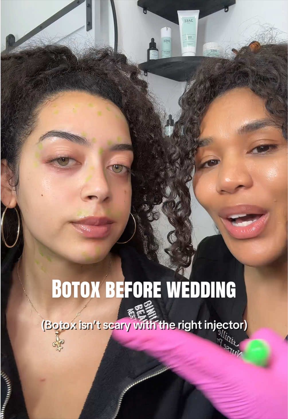 @Botox Filler Skin Los Angeles