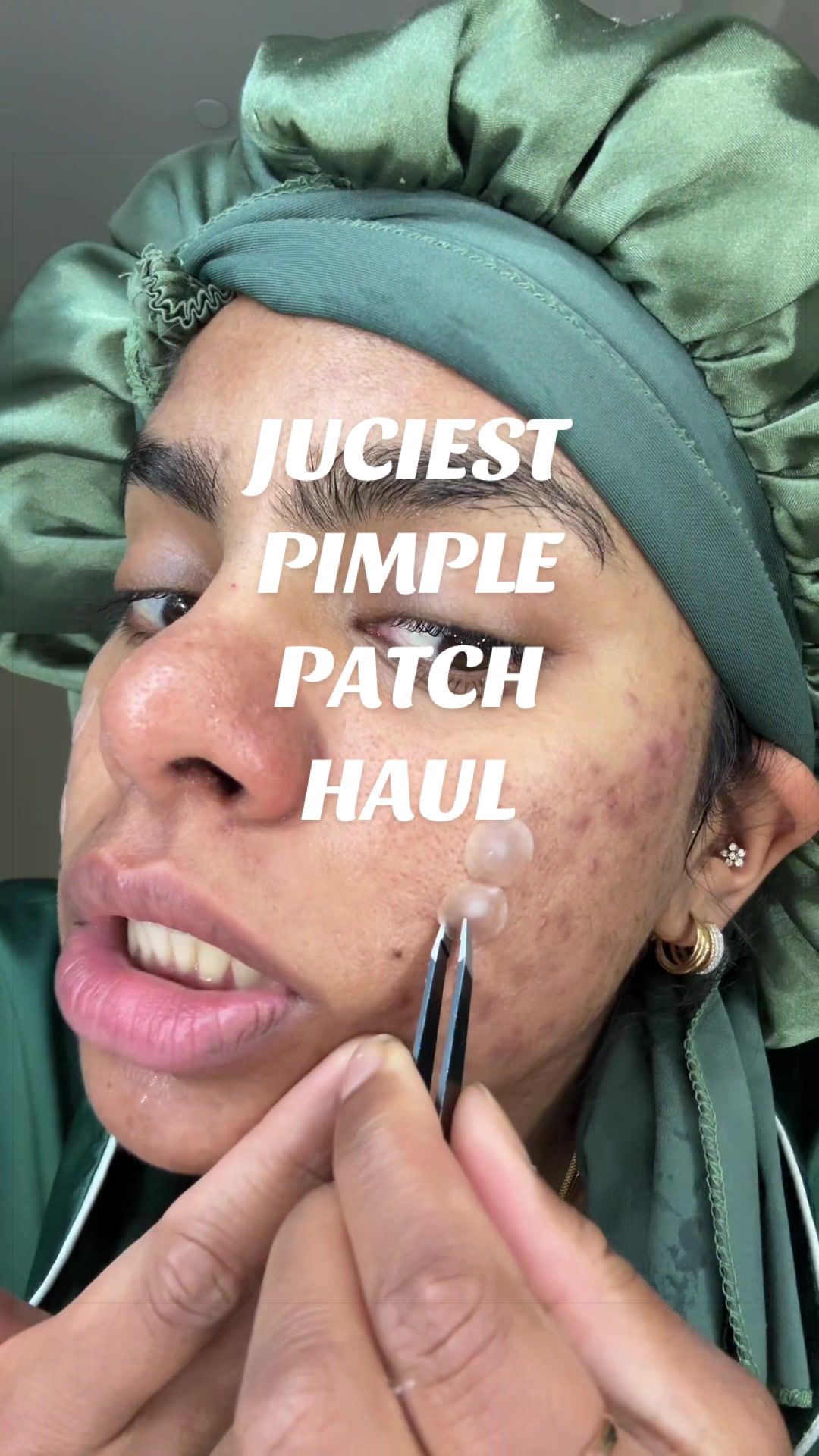 @Nyx Curations | Acne +Wellness