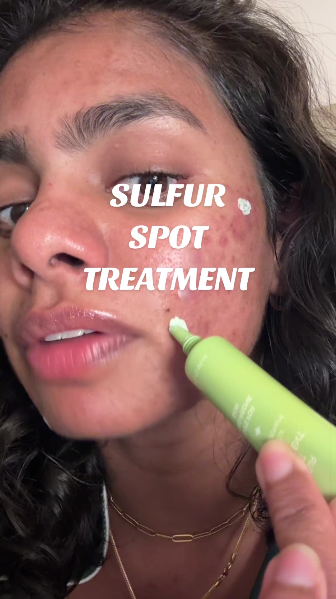 @Nyx Curations | Acne +Wellness