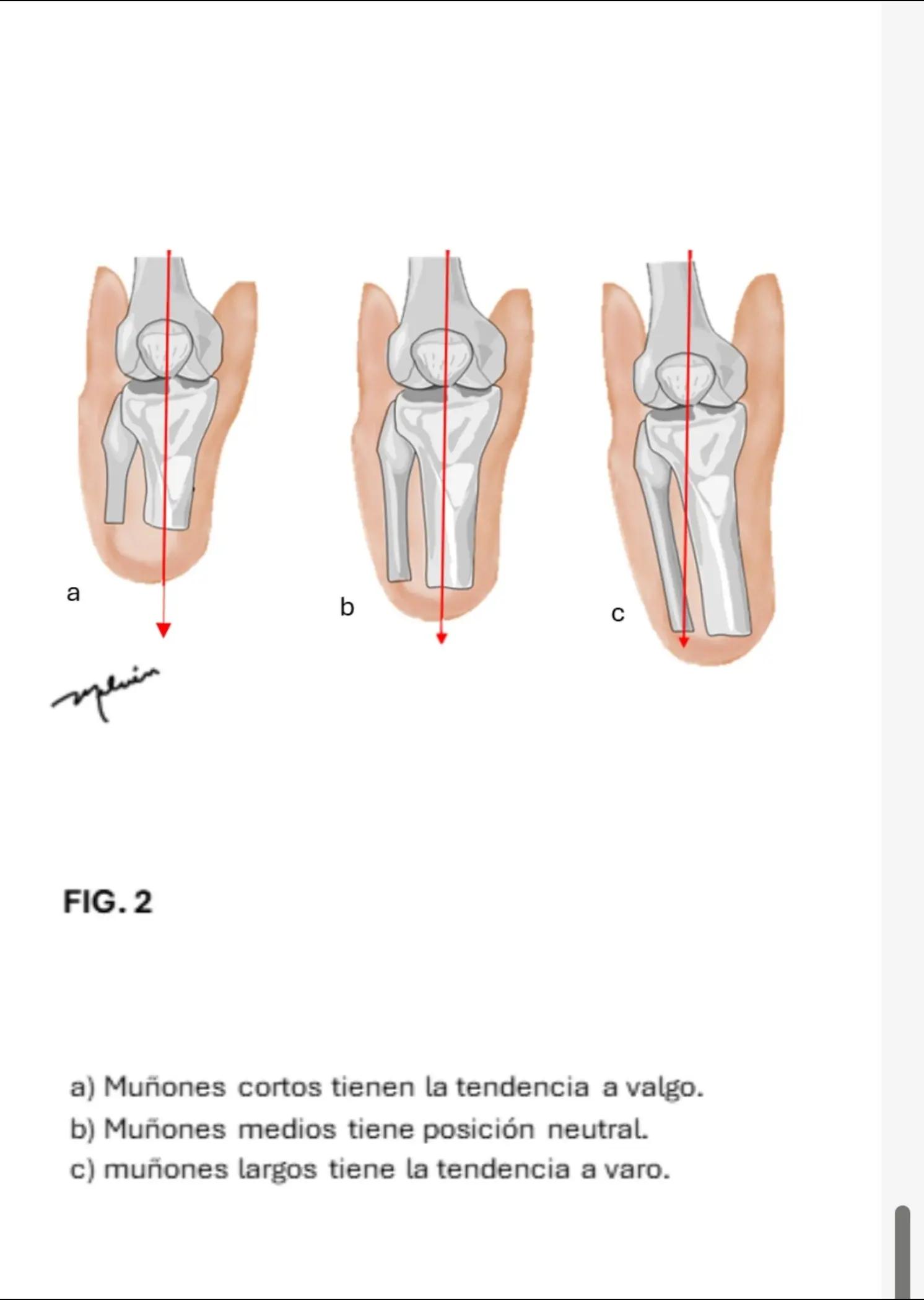@Customized Prótesis