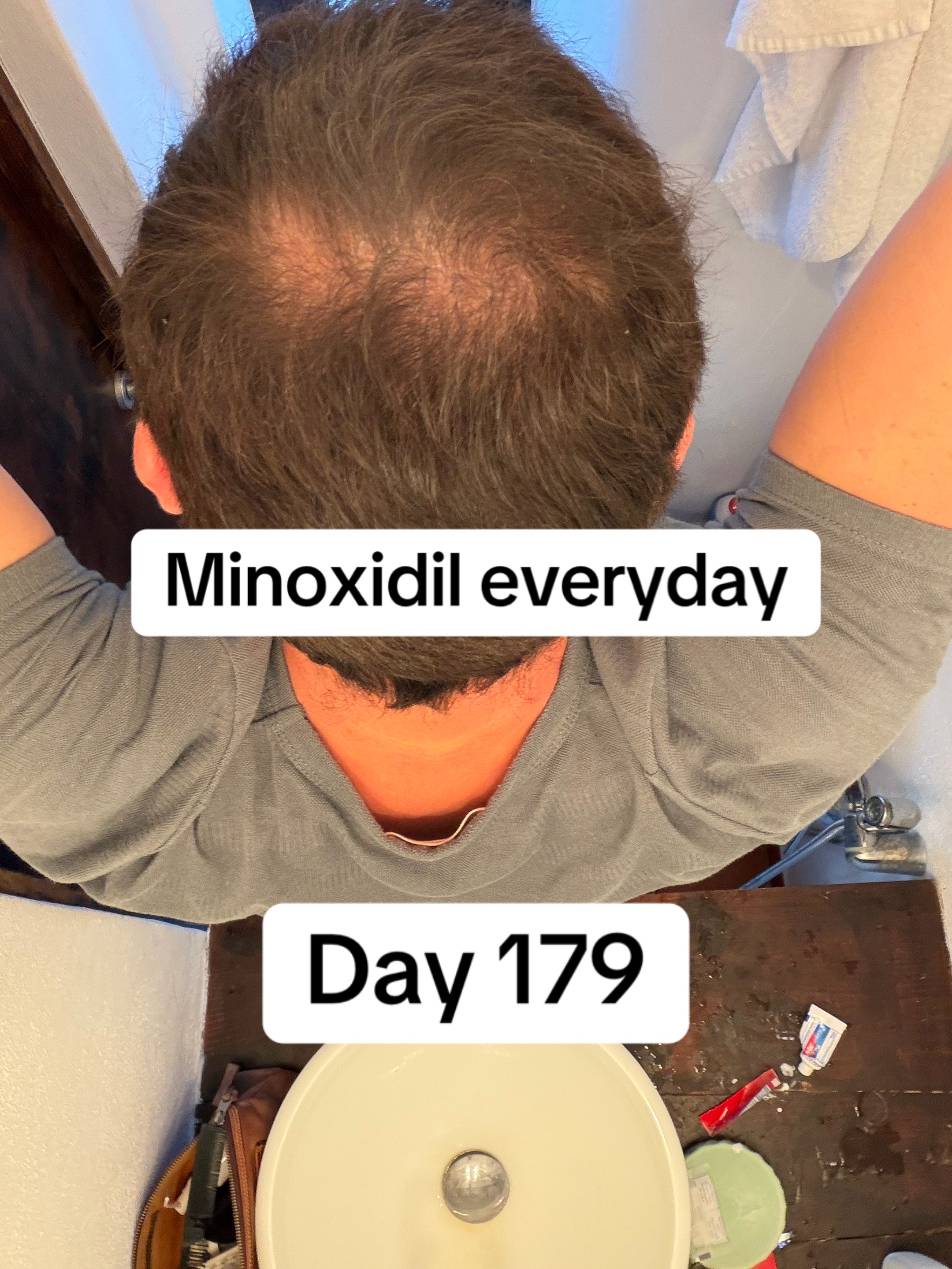 @scalp.hero