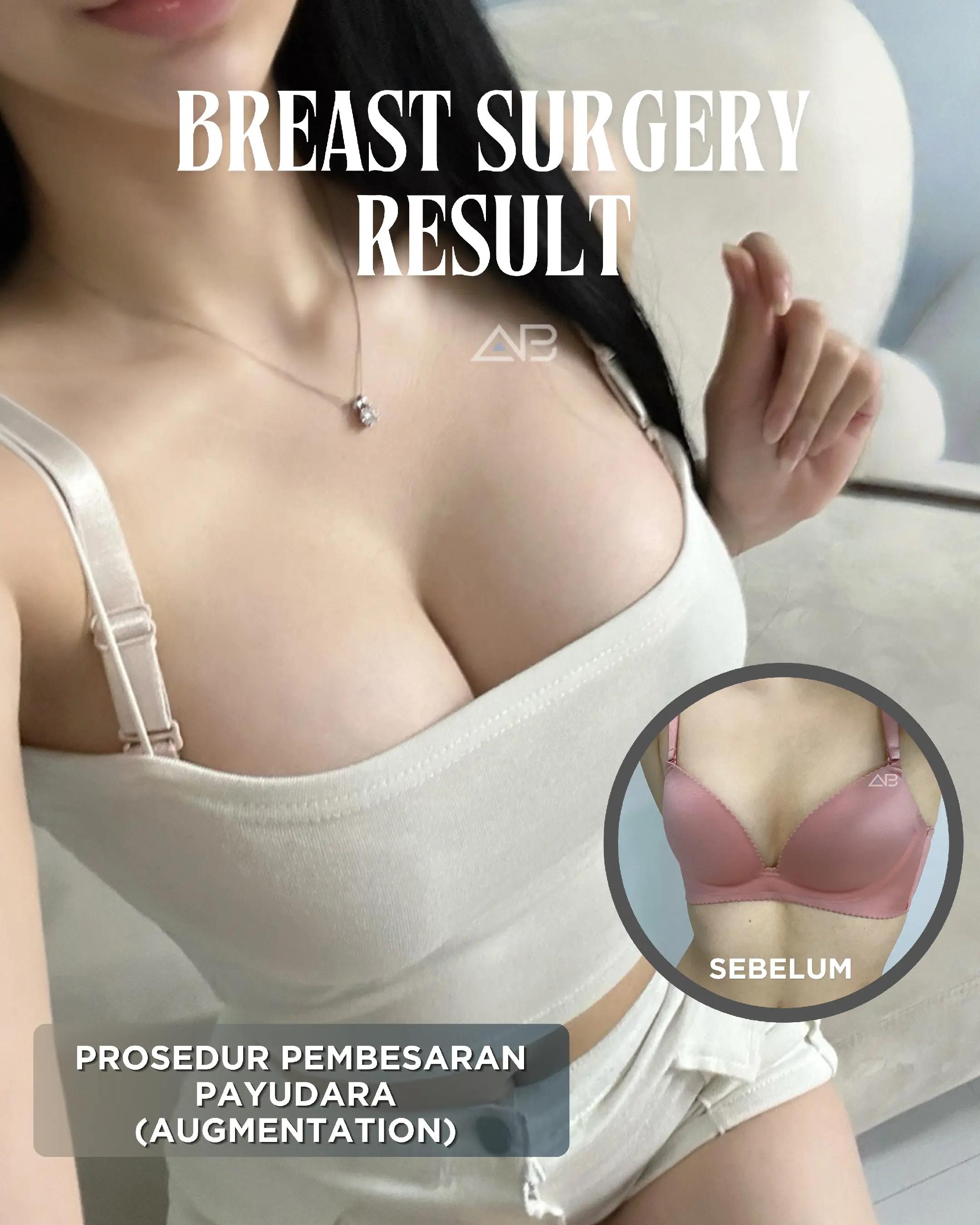 @ABPS Indonesia Official