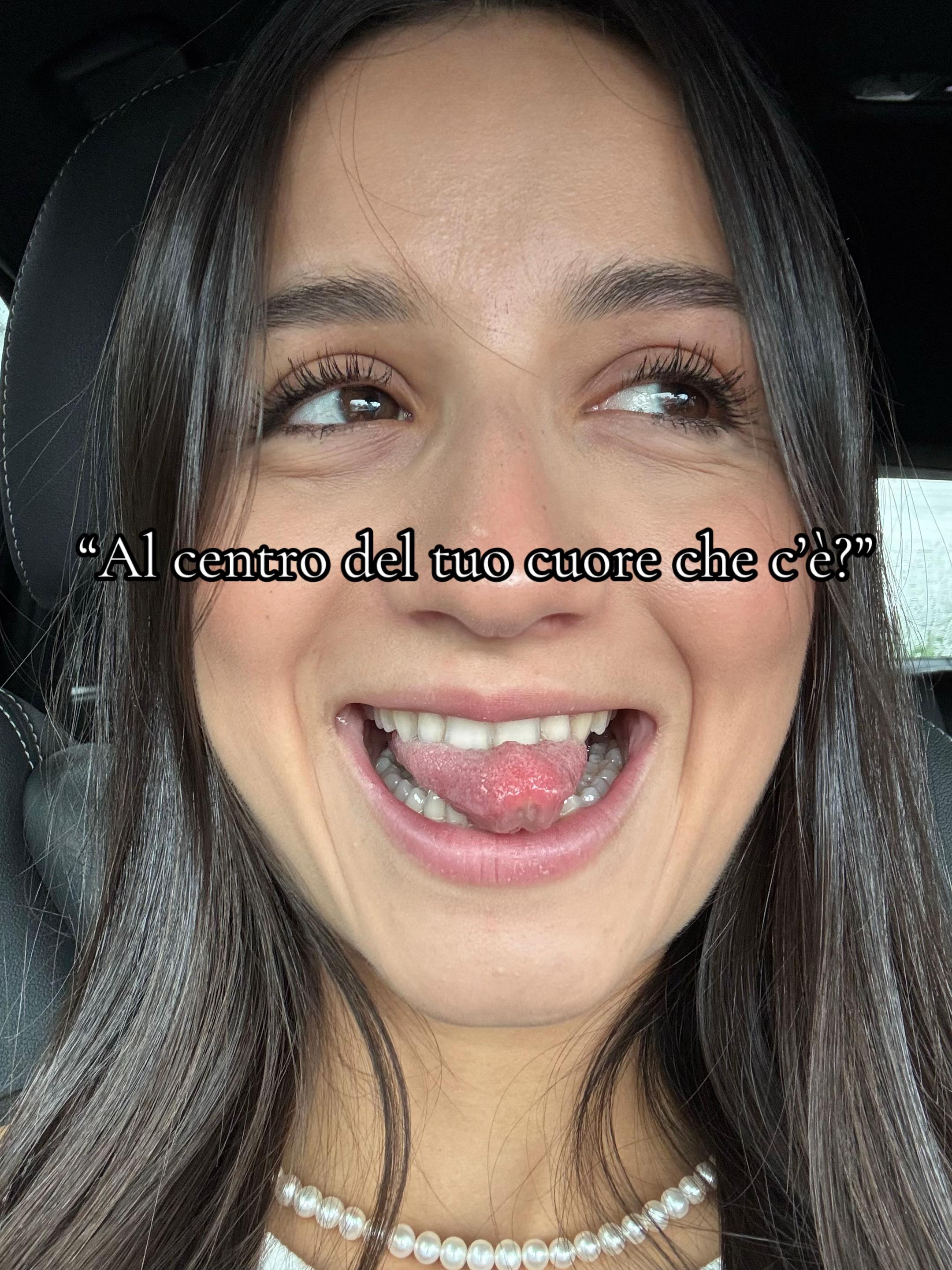 @Camfedele