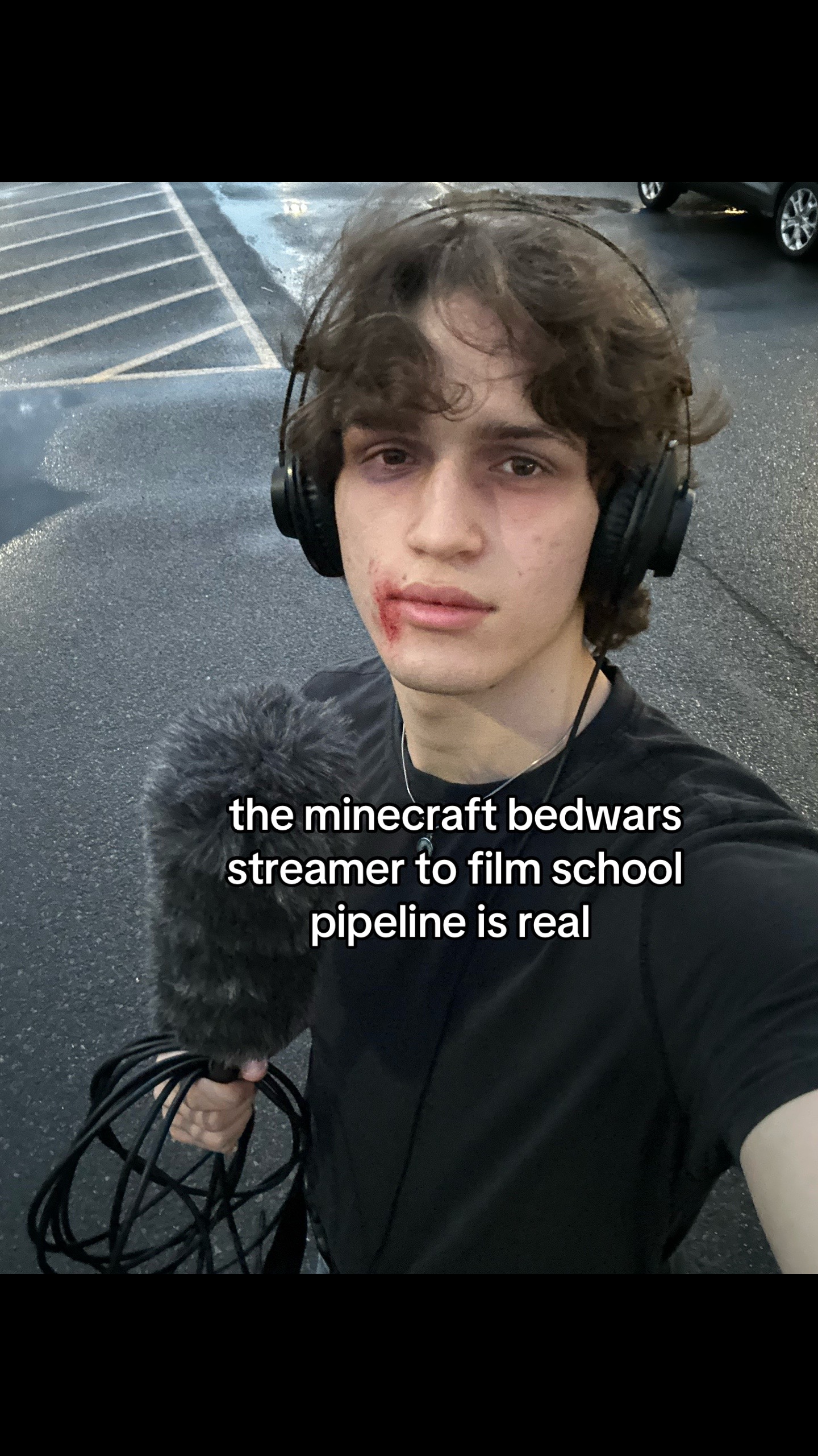 @sensitized