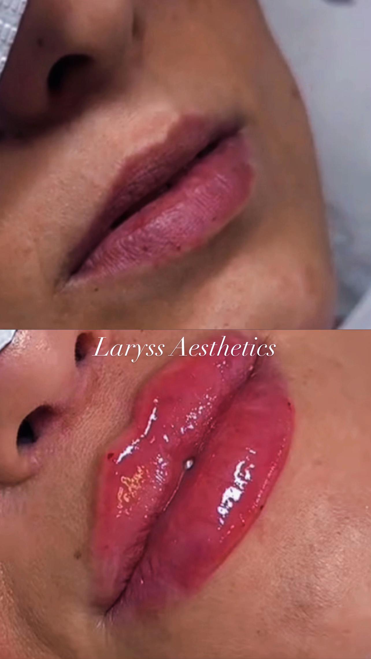 @Laryss Lryy Sebby Ca