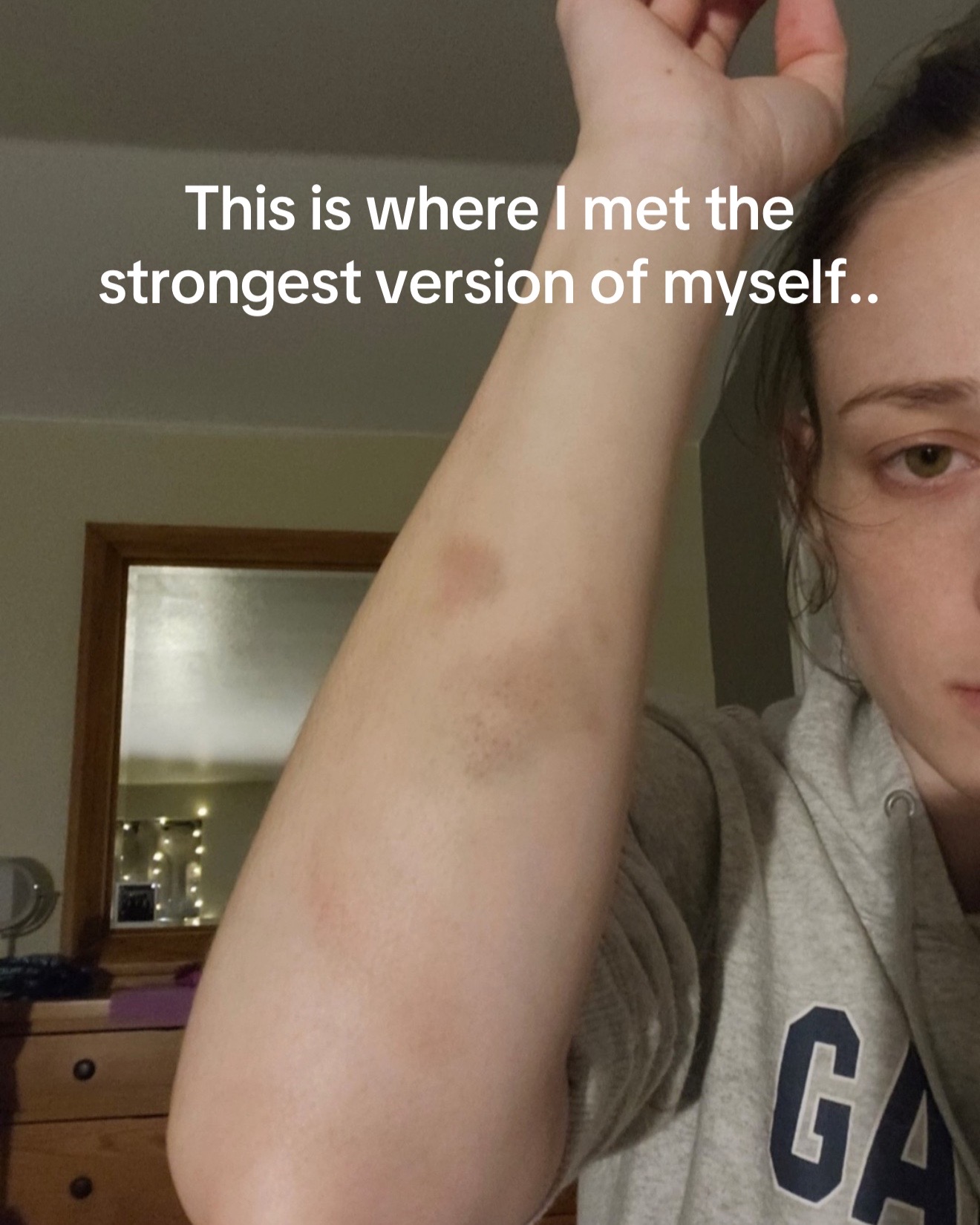 @SurvivingDv