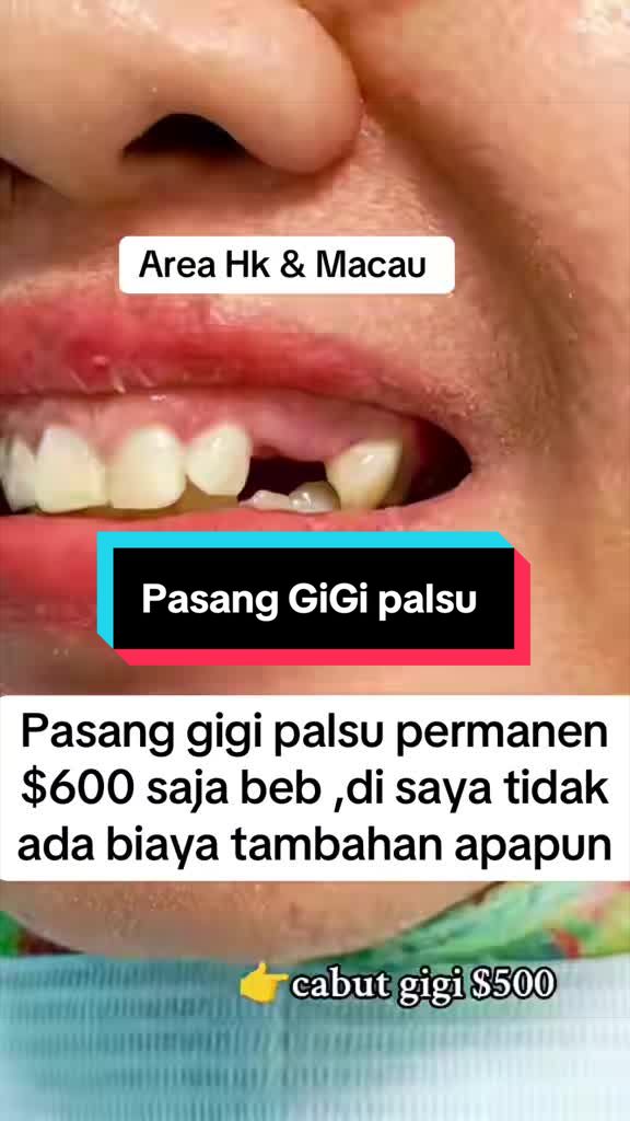 @mbak-Paijem
