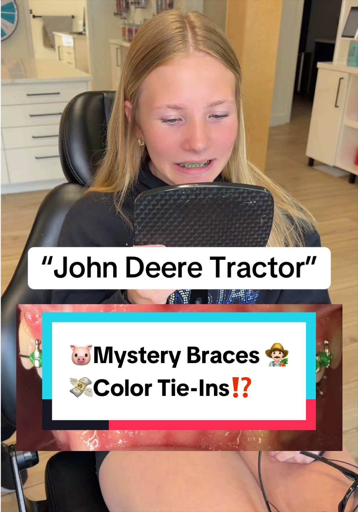 @Braces Survival Guide