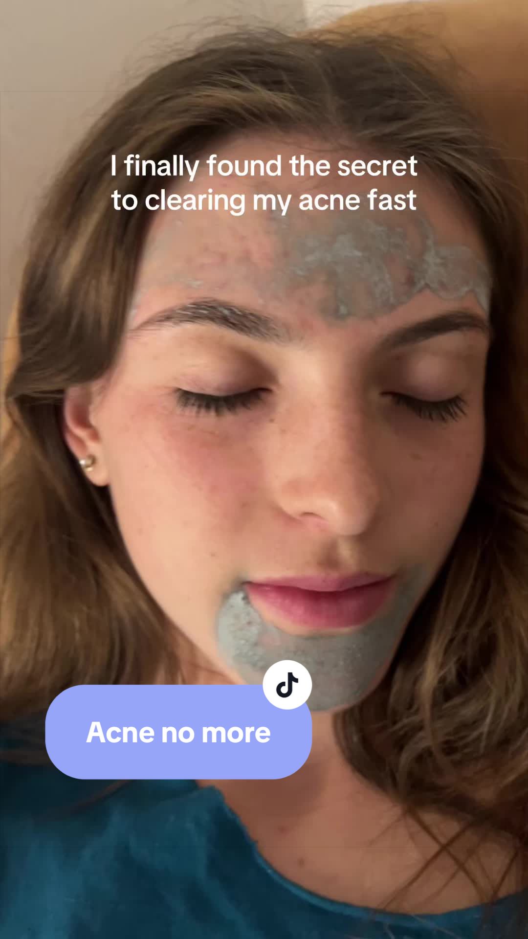 @dewmighty