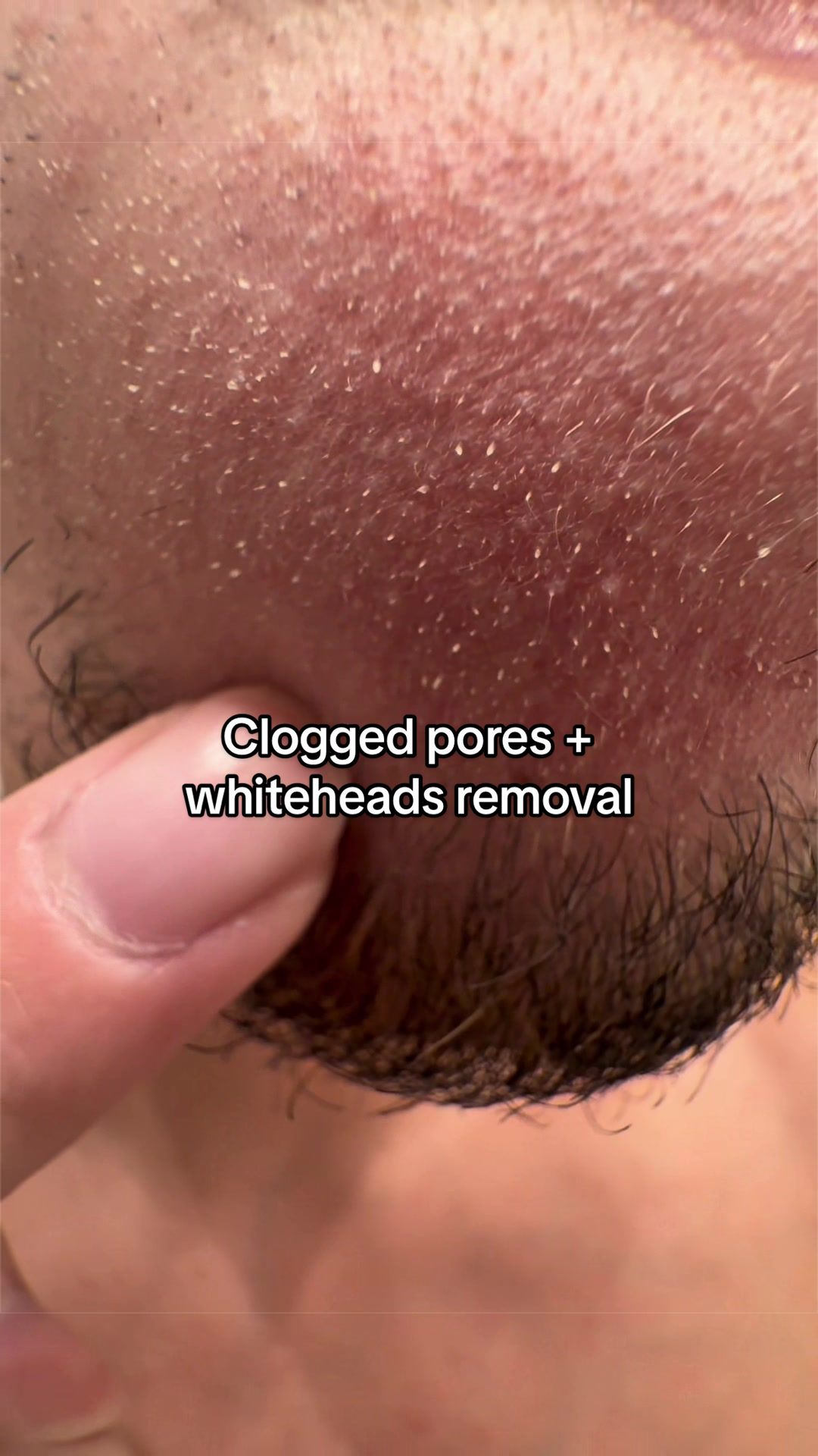@Logan Walter