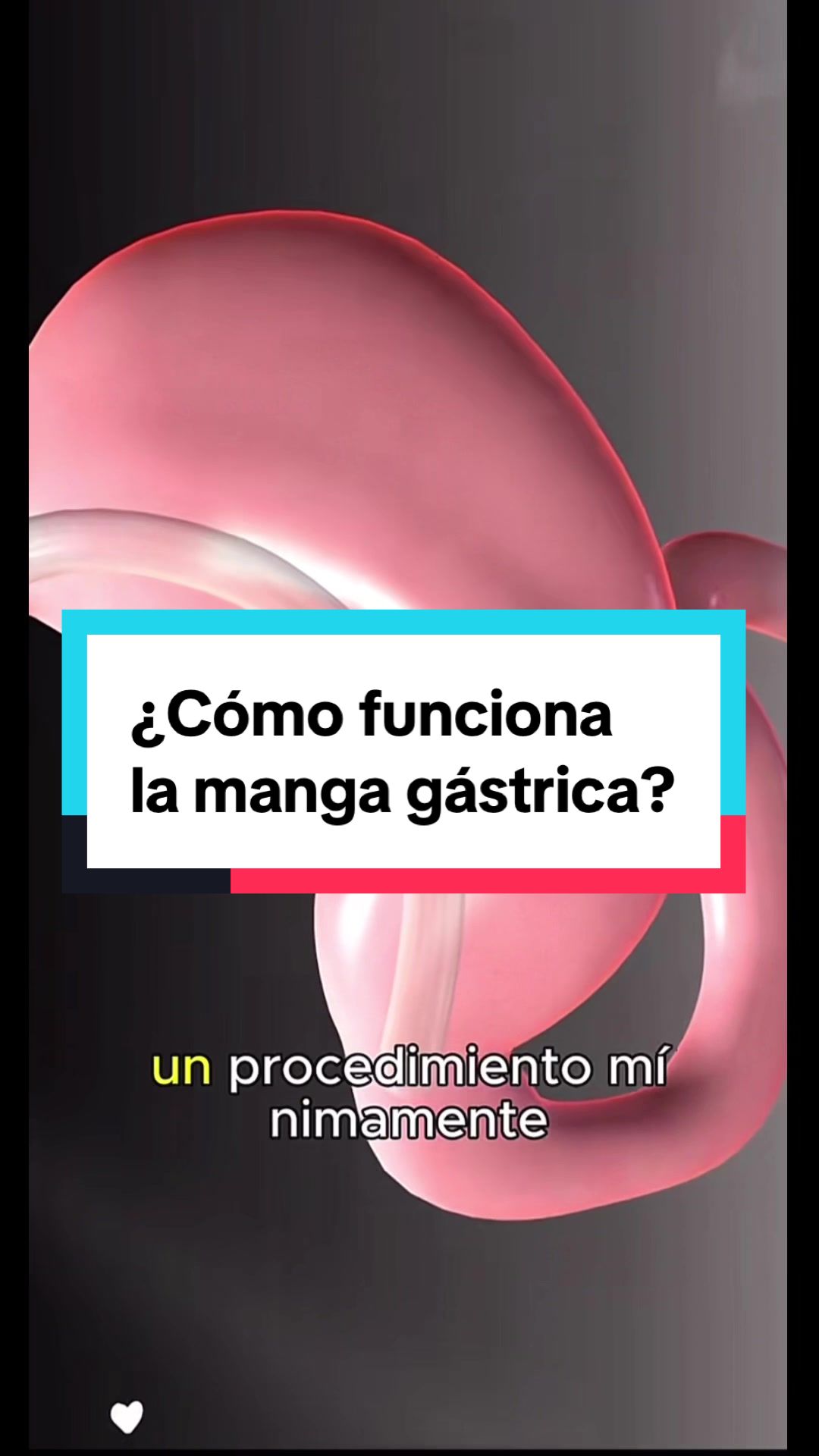 @Dr. Mario del Pino MD FACS