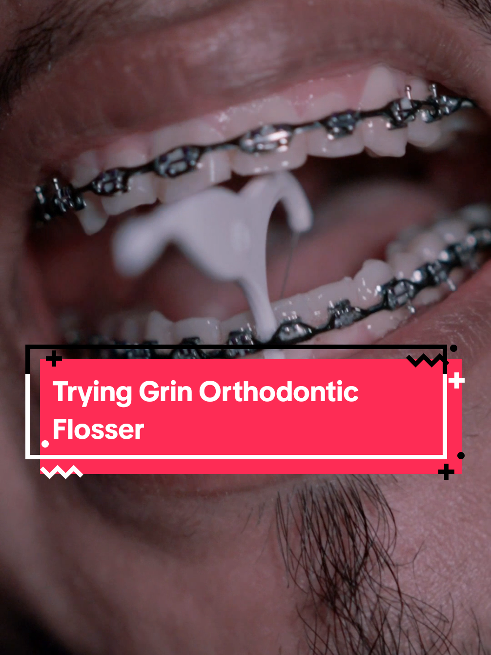 @str8braces