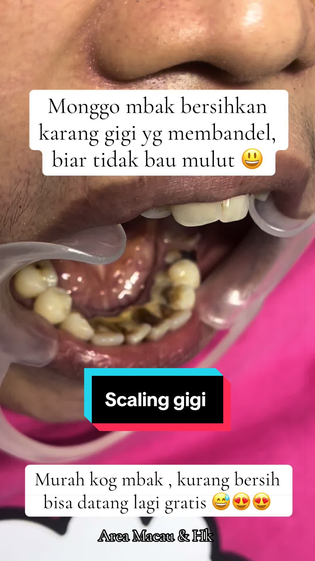 @mbak-Paijem