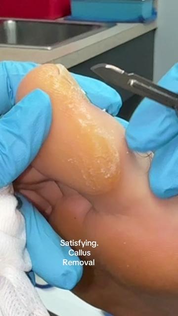 @Deniel Foot and Ankle Center