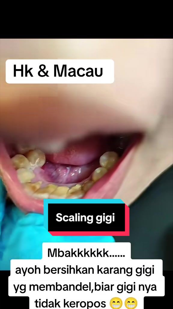 @mbak-Paijem