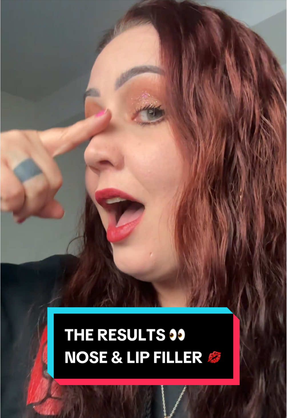 @Laura Lee