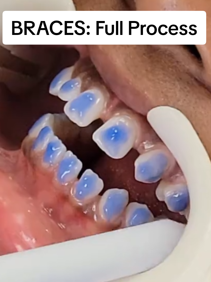 @SmileEnvyDental