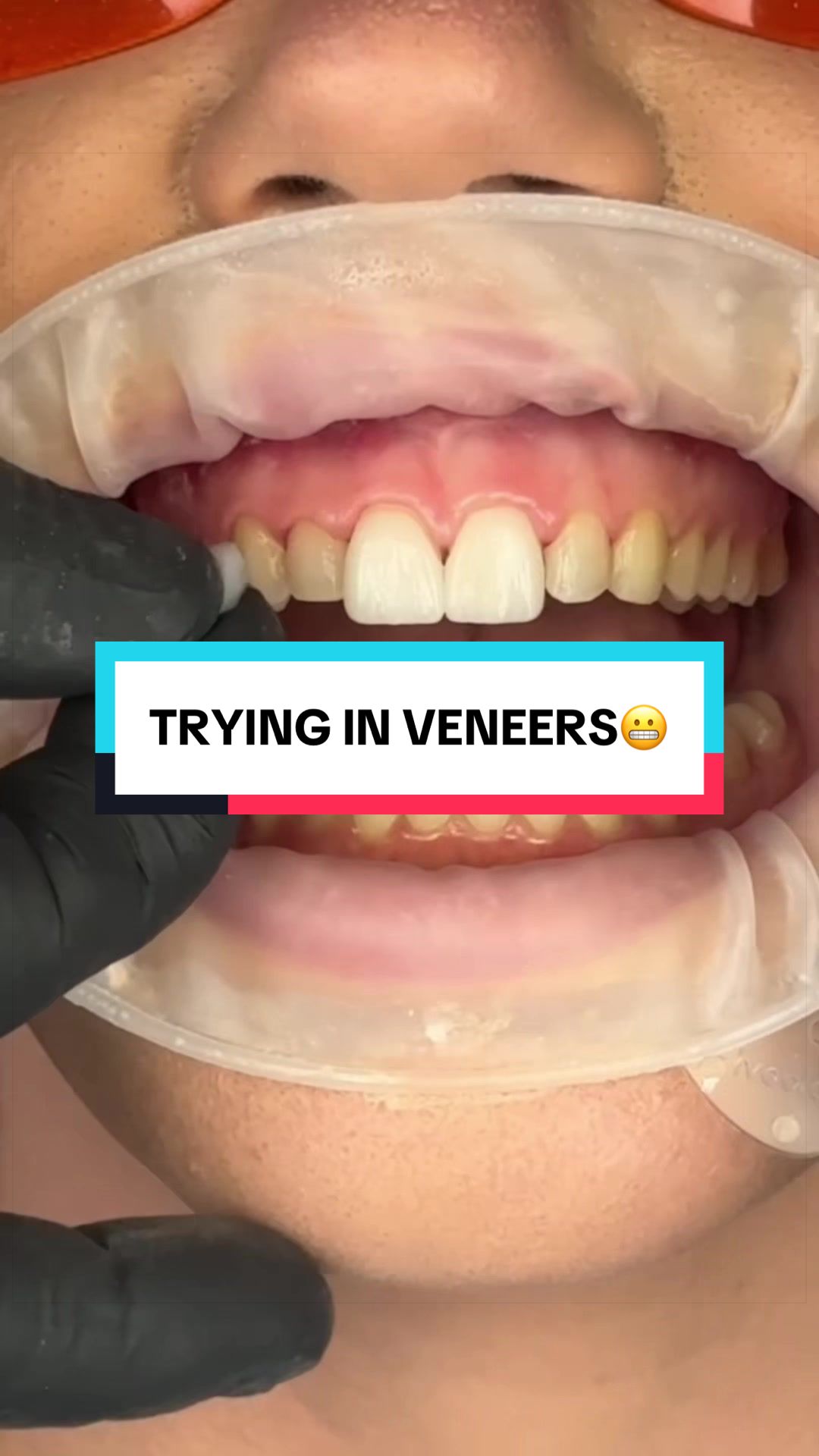 @TikTok Dentist