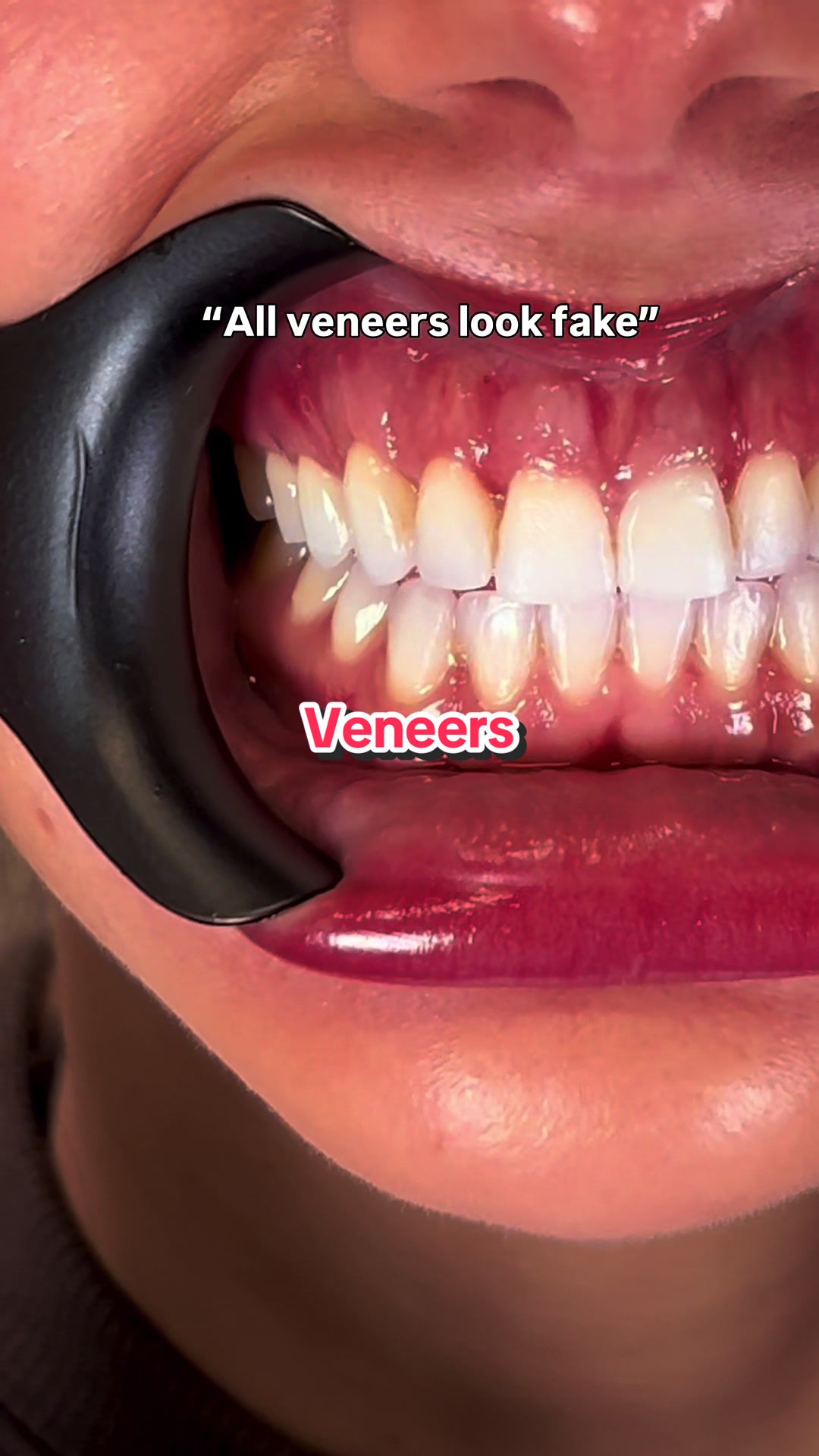 @Joycethedentist