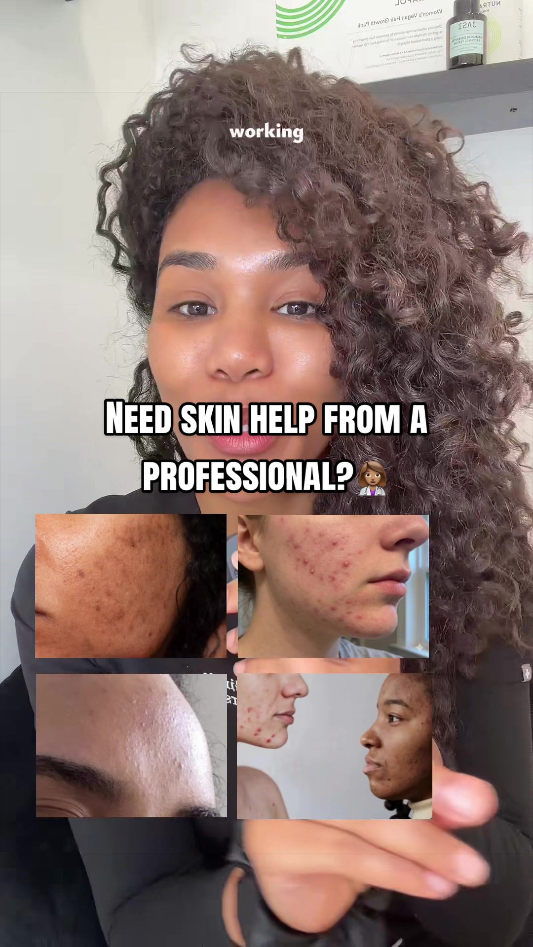 @Botox Filler Skin Los Angeles