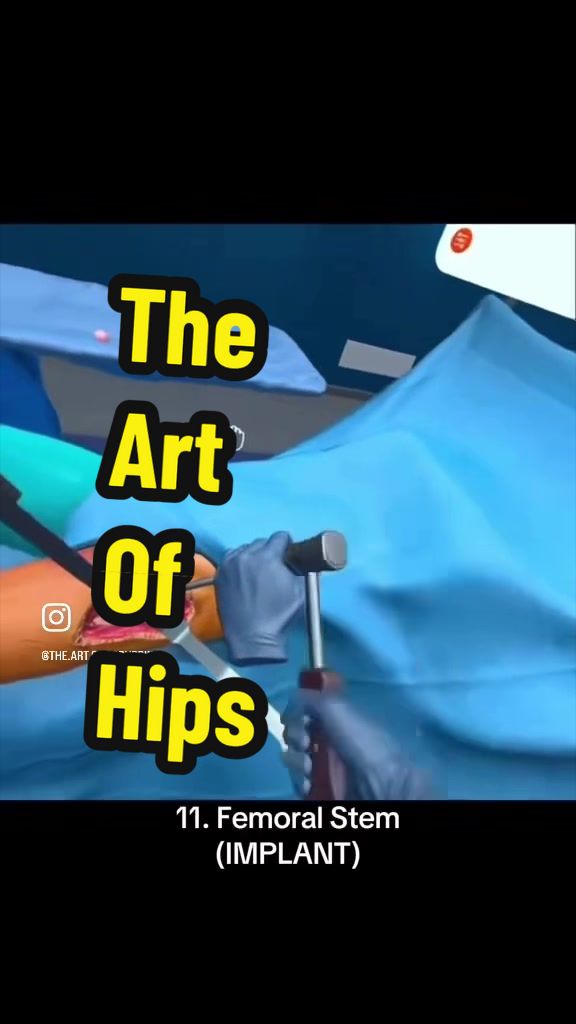 @THE ART OF SCRUBBING