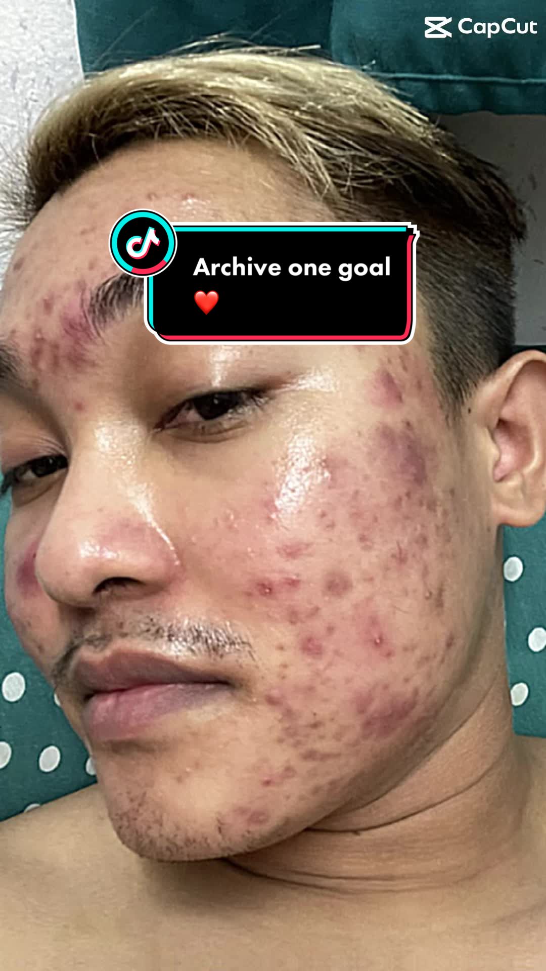 @๐๐ฒ๐๐ฆ๐๐๐ฅ ๐น
