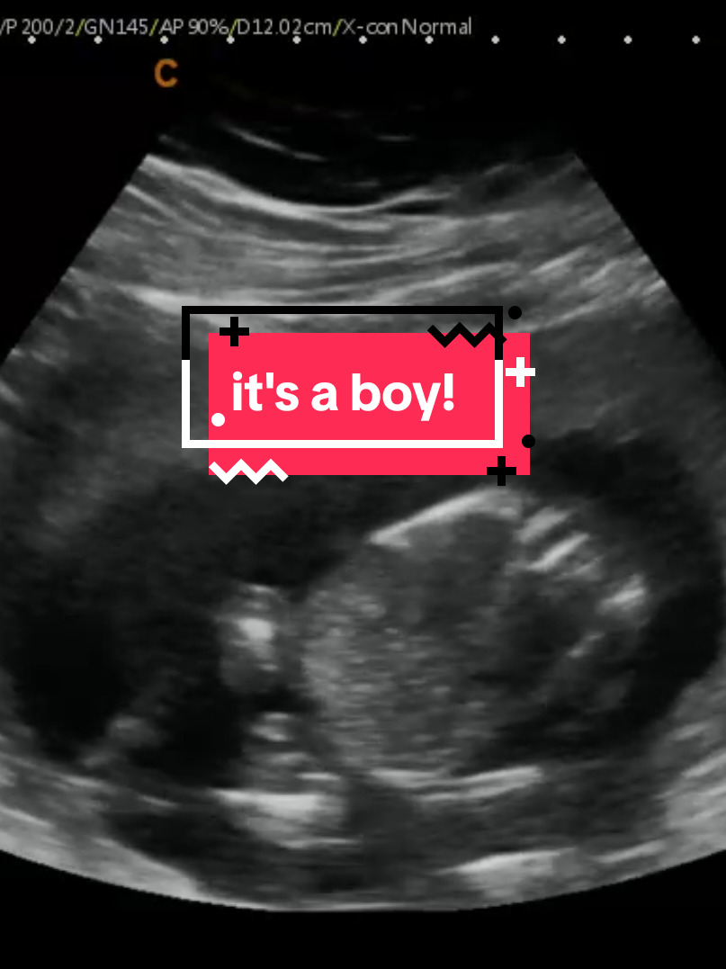 @Hey, Baby!