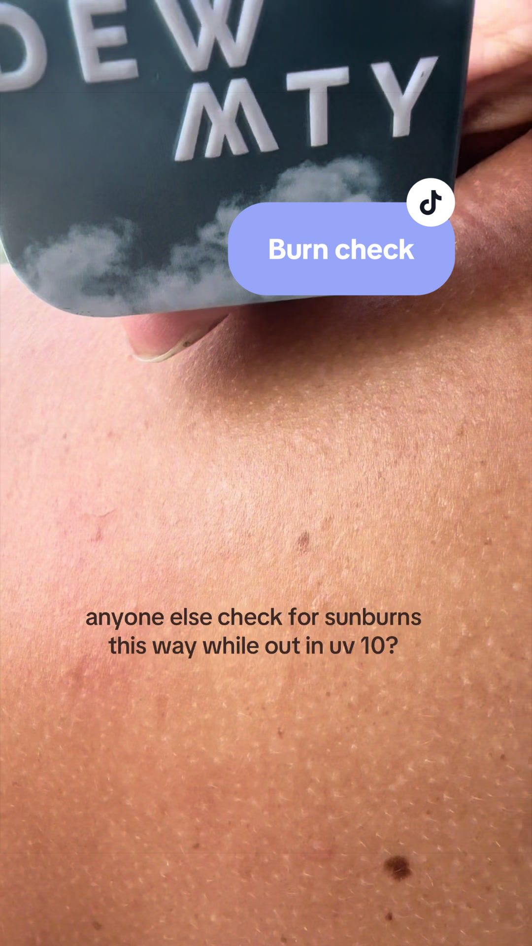 @dewmighty