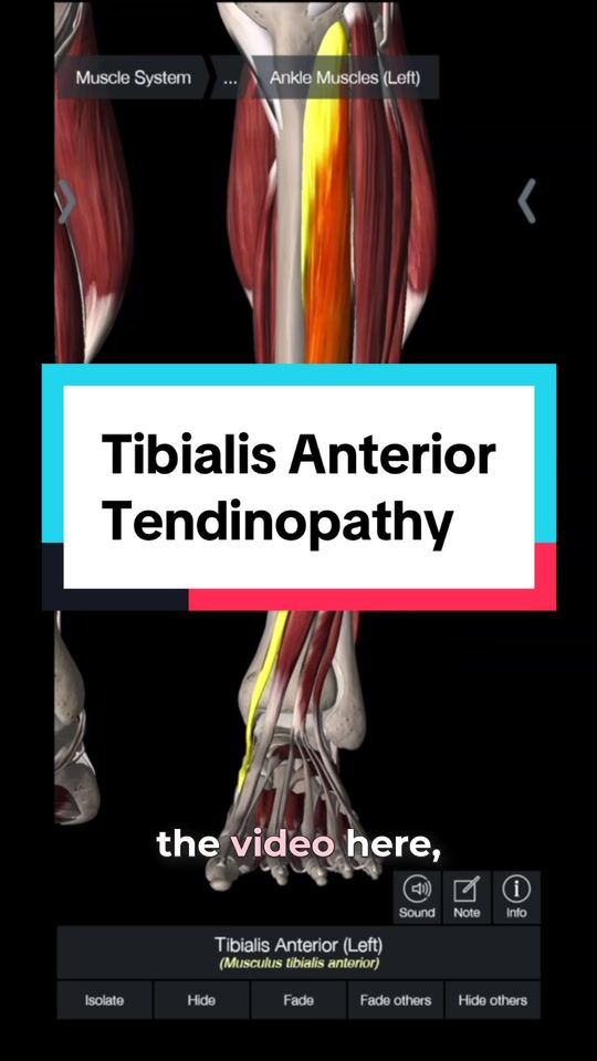 @Jacob Travis, PT, DPT, OCS