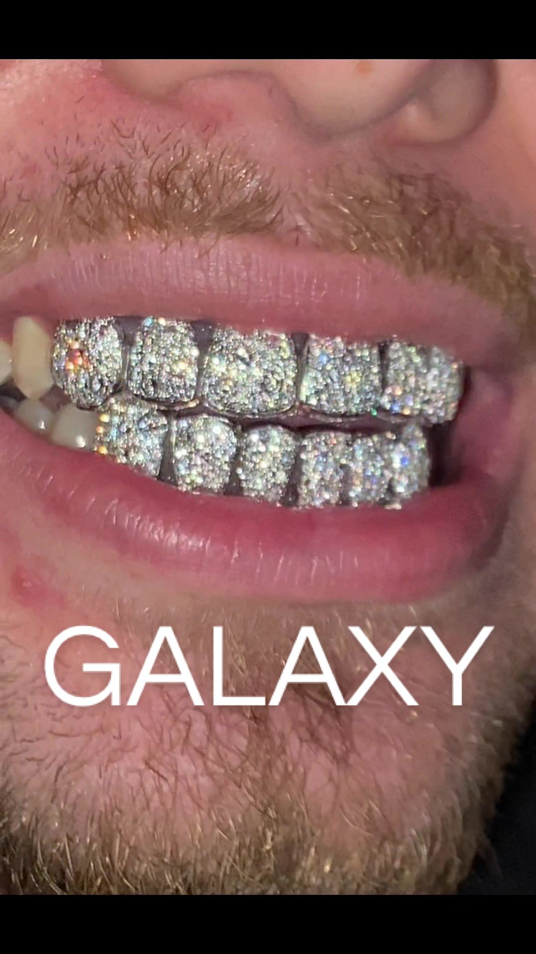 @AMAZING GRILLZ