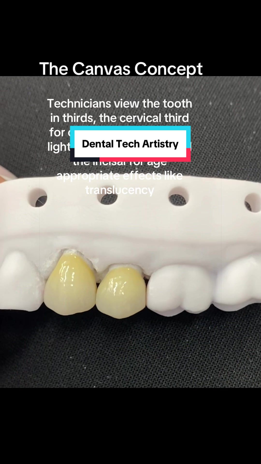 @Dental Tech Hey Jey