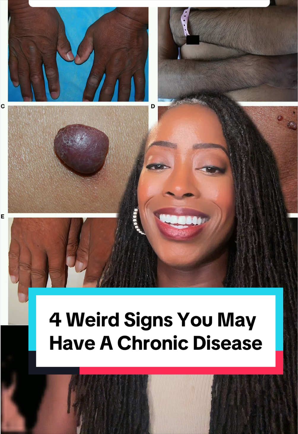 @Christine Nwoha, MD