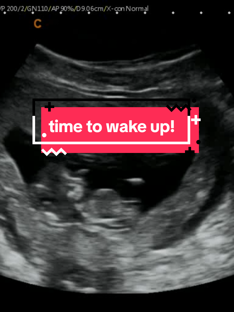 @Hey, Baby!