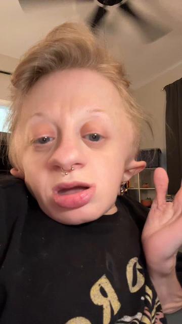 @Abby♿️