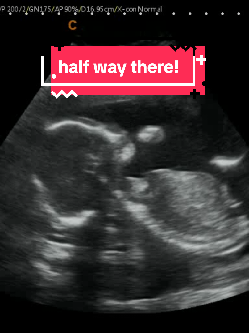 @Hey, Baby!