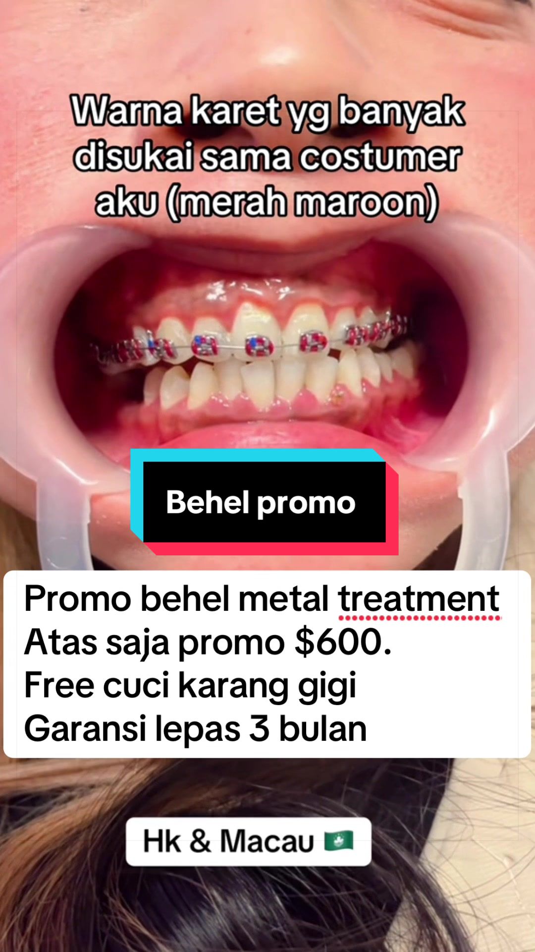 @mbak-Paijem